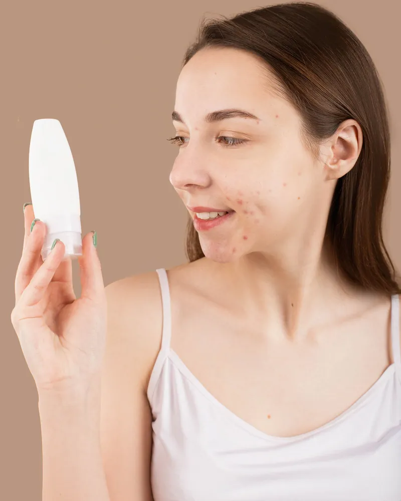 Uma jovem com acne no rosto olha o frasco de um hidratante que segura na mão